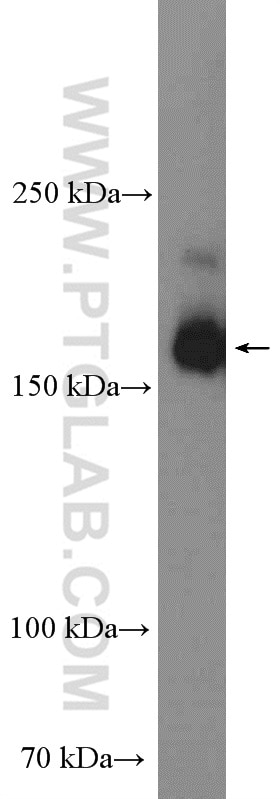 WB analysis of HEK-293 using 22167-1-AP