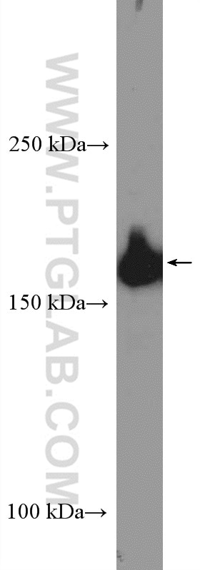 Western Blot (WB) analysis of NIH/3T3 cells using IQGAP1 Polyclonal antibody (22167-1-AP)