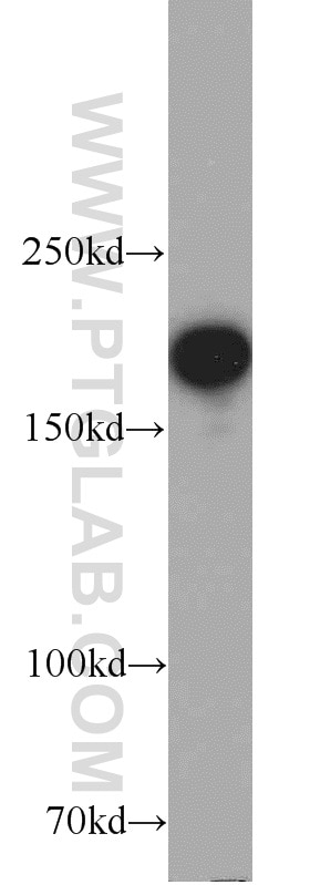 Western Blot (WB) analysis of SGC-7901 cells using IQGAP1 Polyclonal antibody (22167-1-AP)
