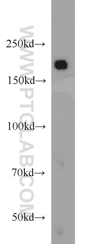 Western Blot (WB) analysis of HeLa cells using IQGAP1 Polyclonal antibody (22167-1-AP)