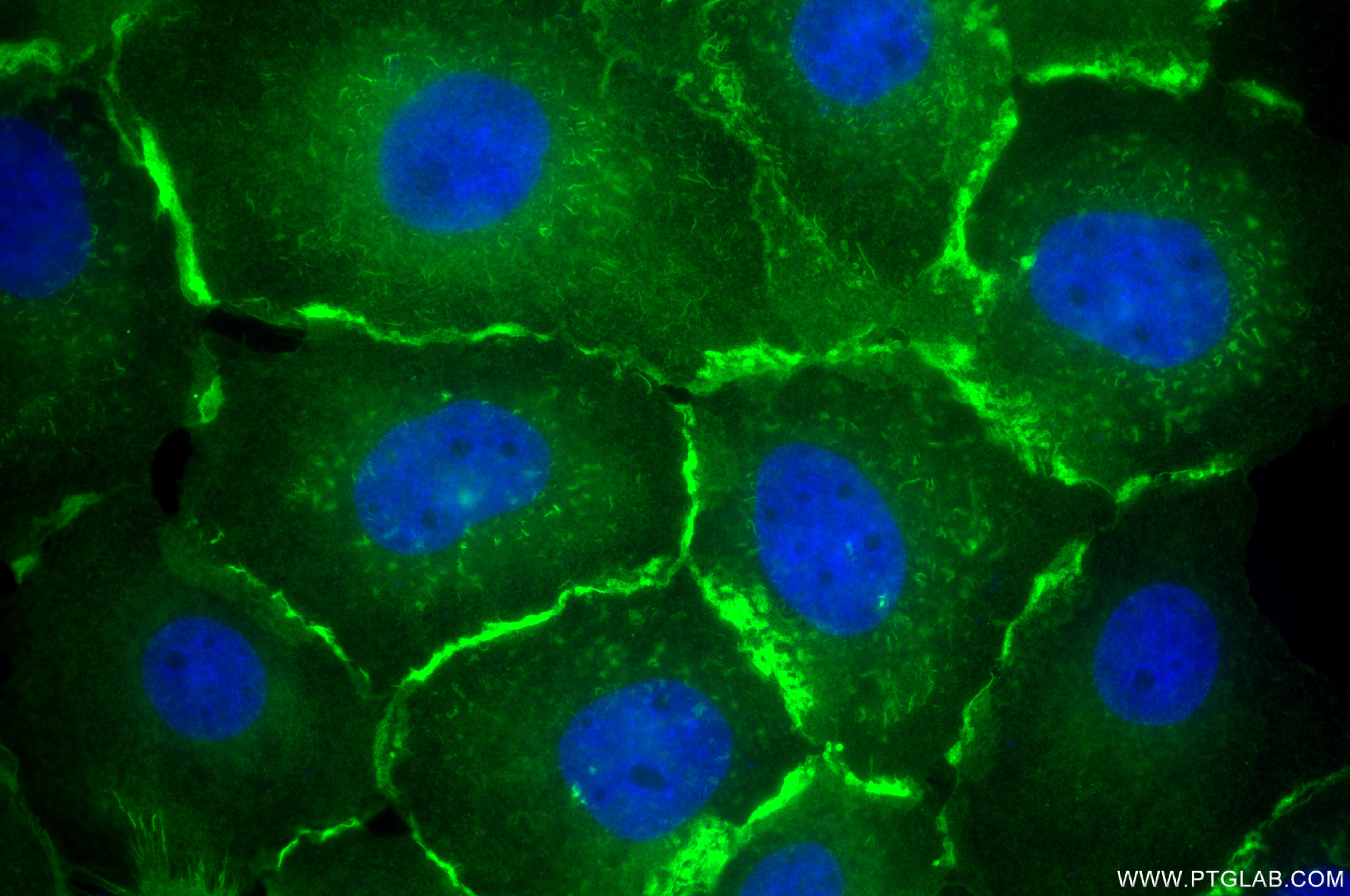 Immunofluorescence (IF) / fluorescent staining of A431 cells using IQGAP1 Recombinant antibody (85651-1-RR)