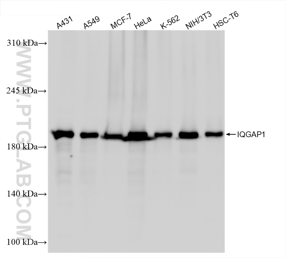 IQGAP1