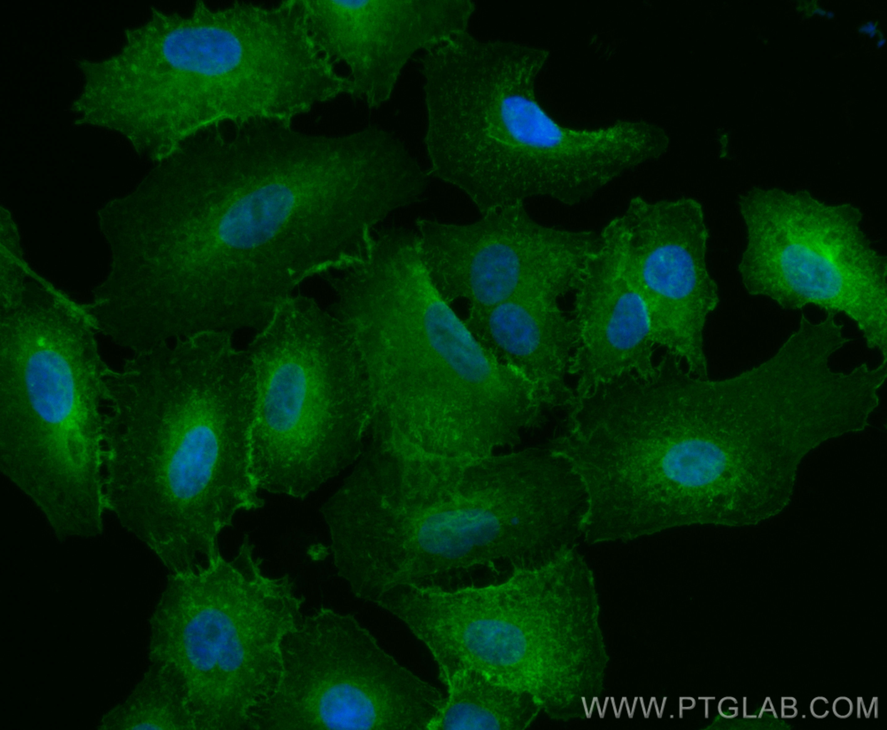 Immunofluorescence (IF) / fluorescent staining of A549 cells using CoraLite® Plus 488-conjugated IQGAP1 Polyclonal an (CL488-22167)