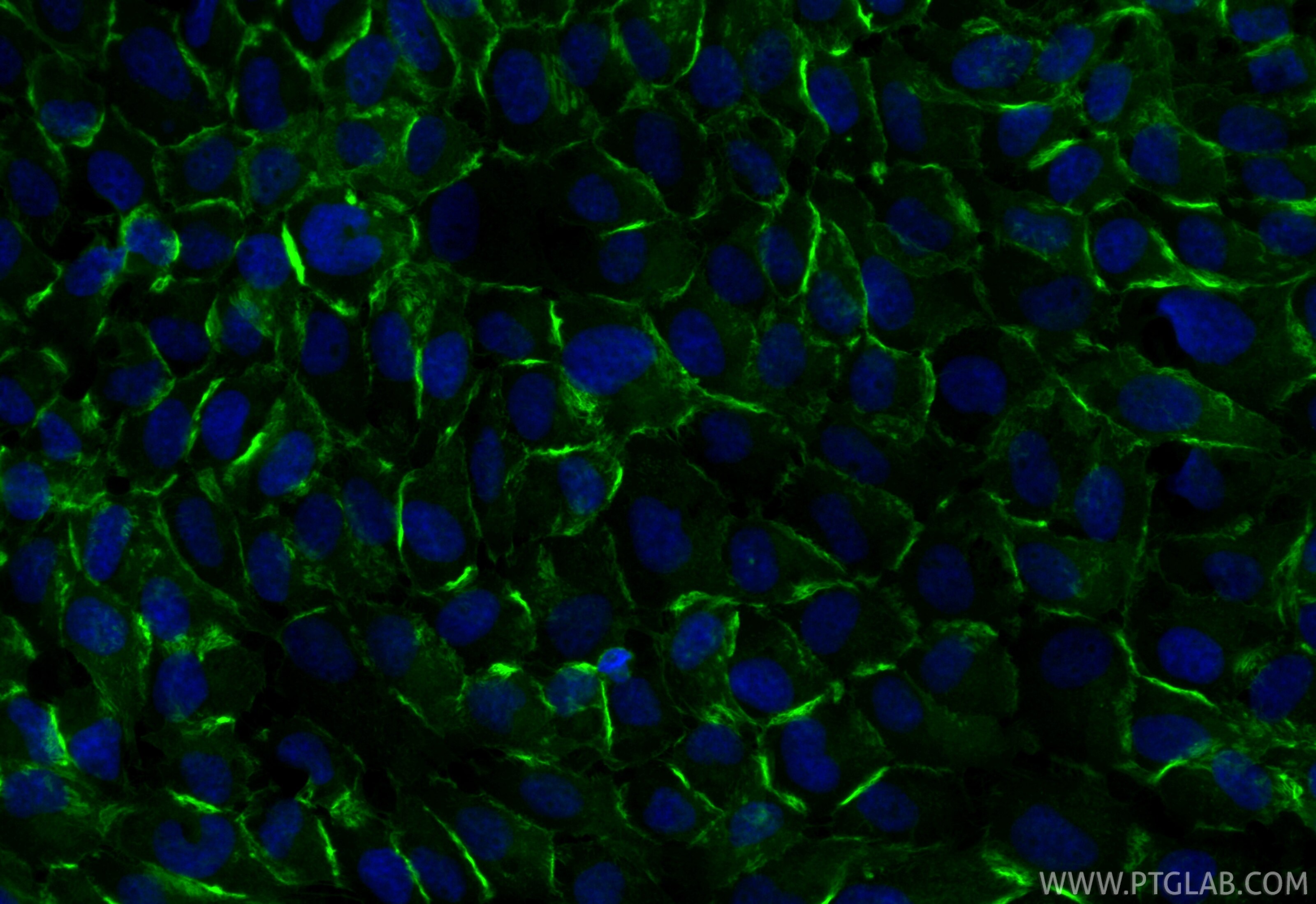 Immunofluorescent analysis of (4% PFA) fixed A431 cells using CoraLite® Plus 488 IQGAP1 antibody (CL488-85651, Clone: 242206G2 ) at dilution of 1:200. Immunofluorescence (IF) / fluorescent staining of A431 cells using CoraLite® Plus 488-conjugated IQGAP1 Recombinant m (CL488-85651)