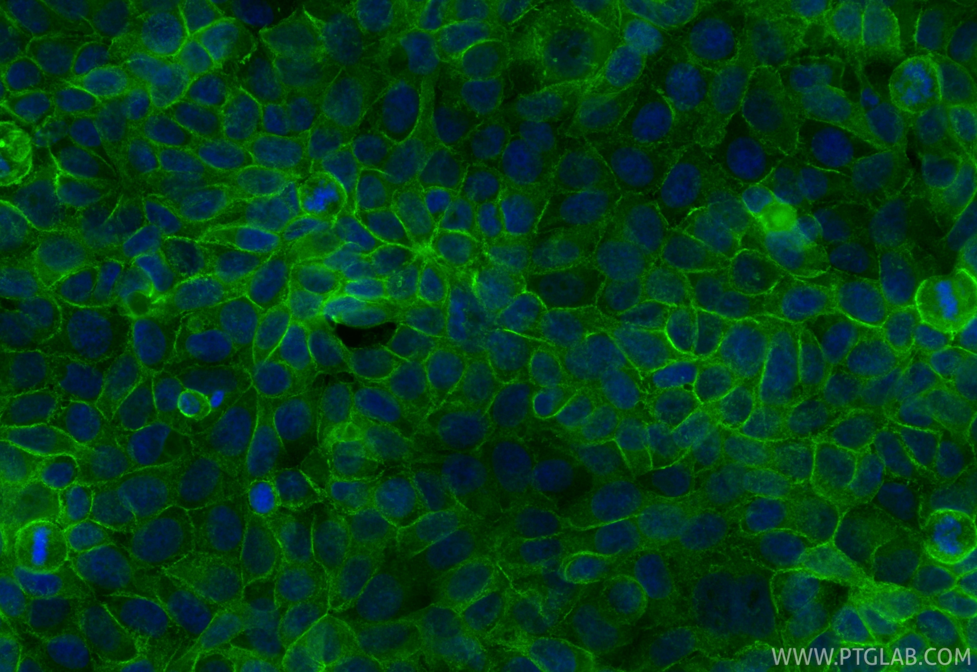 Immunofluorescent analysis of (4% PFA) fixed MCF-7 cells using CoraLite® Plus 488 IQGAP1 antibody (CL488-85651, Clone: 242206G2 ) at dilution of 1:200. Immunofluorescence (IF) / fluorescent staining of MCF-7 cells using CoraLite® Plus 488-conjugated IQGAP1 Recombinant m (CL488-85651)