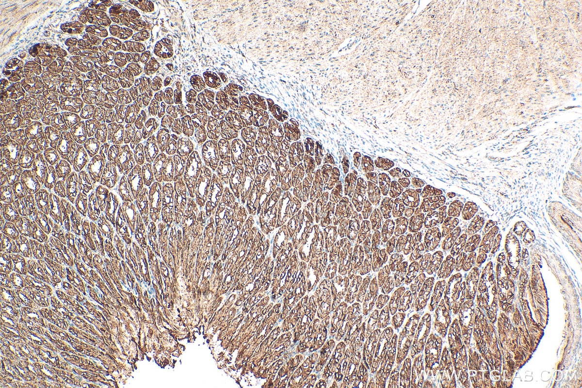 Immunohistochemistry (IHC) staining of mouse stomach tissue using IQGAP2 Polyclonal antibody (30692-1-AP)