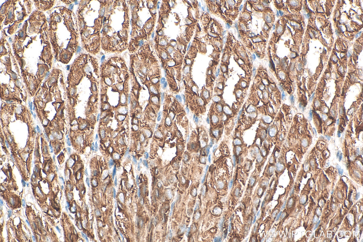 Immunohistochemistry (IHC) staining of mouse stomach tissue using IQGAP2 Polyclonal antibody (30692-1-AP)