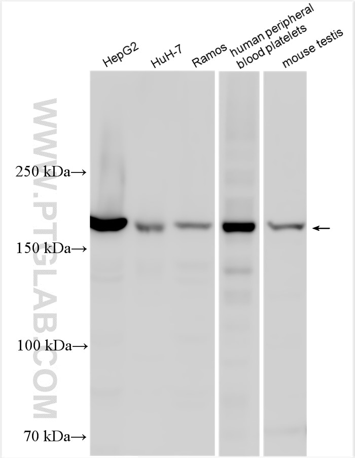 Western Blot (WB) analysis of various lysates using IQGAP2 Polyclonal antibody (30692-1-AP)