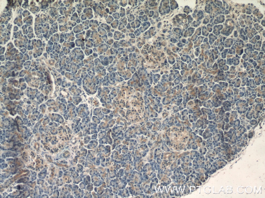 Immunohistochemistry (IHC) staining of human pancreas tissue using IQGAP2 Polyclonal antibody (55189-1-AP)
