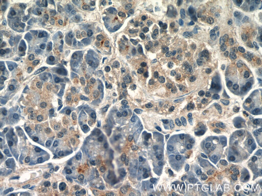 Immunohistochemistry (IHC) staining of human pancreas tissue using IQGAP2 Polyclonal antibody (55189-1-AP)