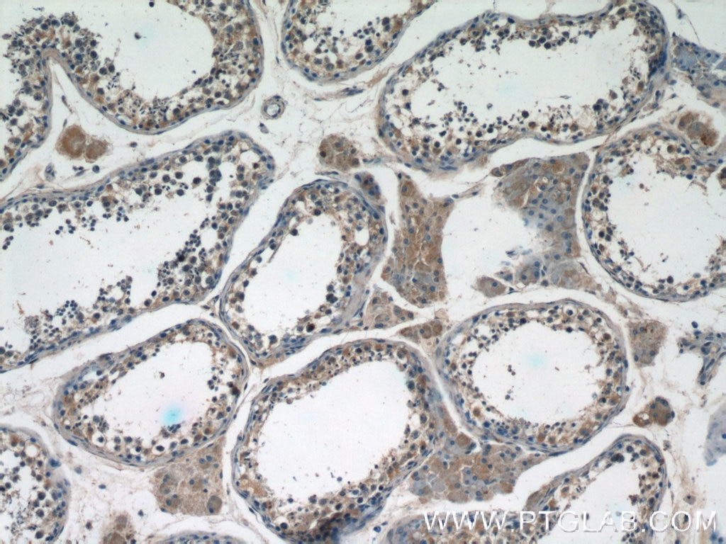 Immunohistochemistry (IHC) staining of human testis tissue using IQGAP2 Polyclonal antibody (55189-1-AP)