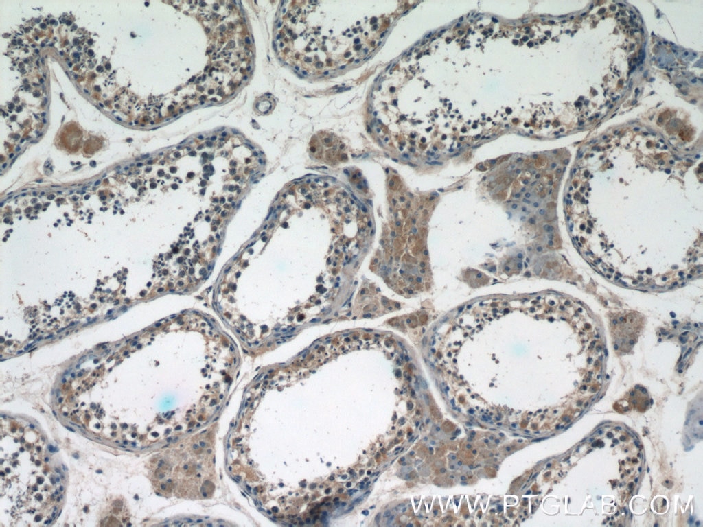 IHC staining of human testis using 55189-1-AP