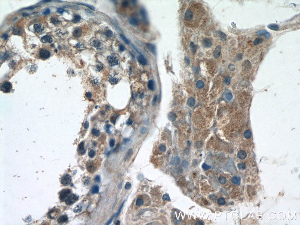 Immunohistochemistry (IHC) staining of human testis tissue using IQGAP2 Polyclonal antibody (55189-1-AP)