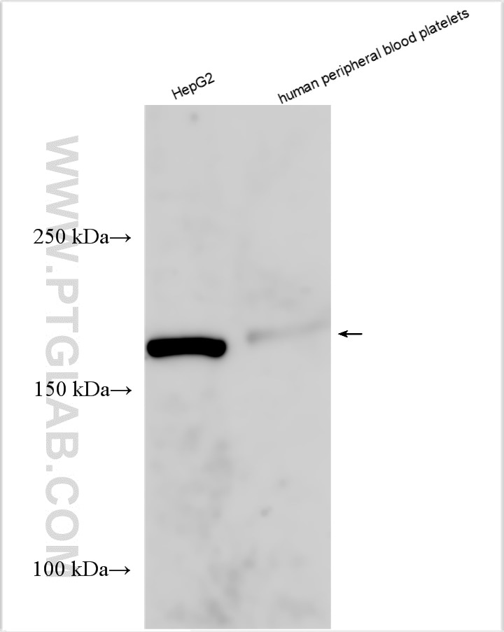 Western Blot (WB) analysis of various lysates using IQGAP2 Polyclonal antibody (55189-1-AP)