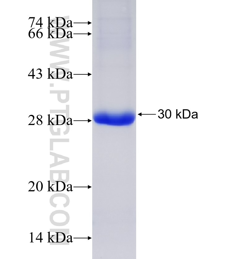 IQGAP2 fusion protein Ag33499 SDS-PAGE