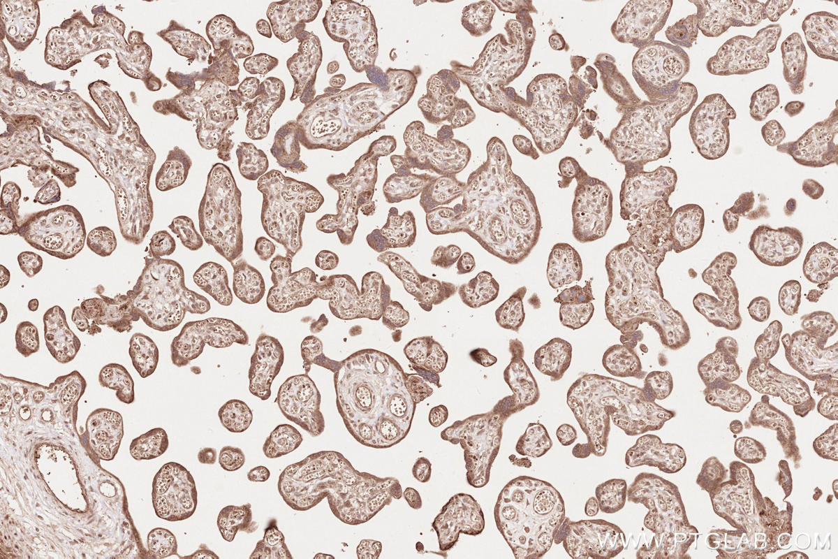 Immunohistochemistry (IHC) staining of human placenta tissue using IQGAP3 Polyclonal antibody (25930-1-AP)