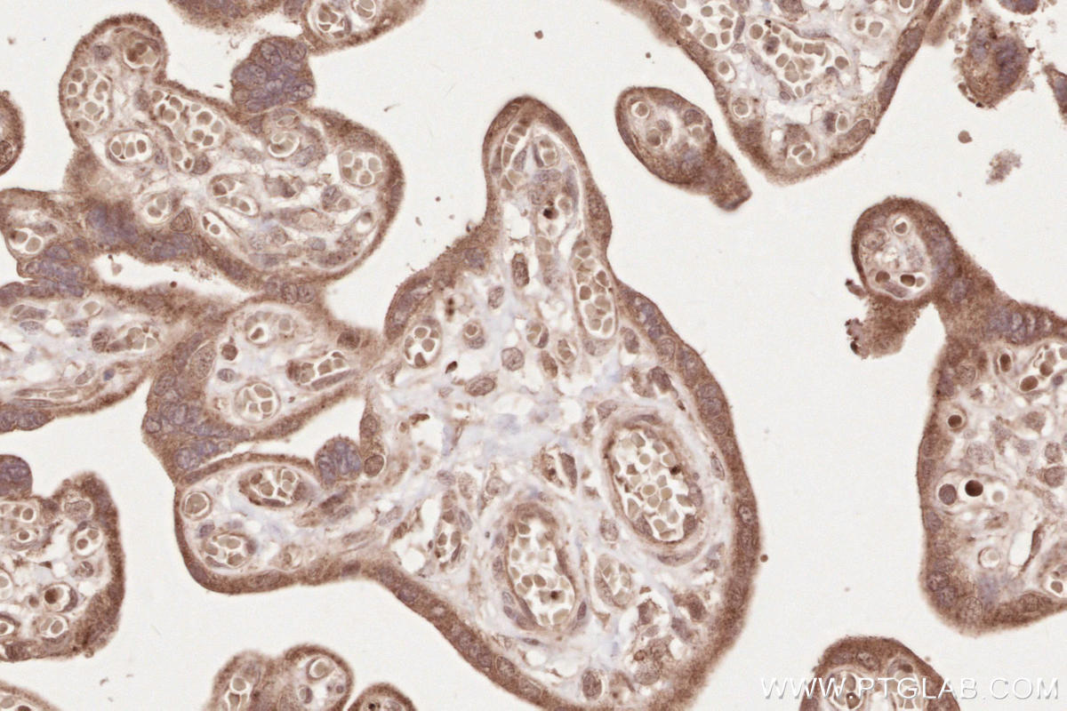 IHC staining of human placenta using 25930-1-AP Immunohistochemistry (IHC) staining of human placenta tissue using IQGAP3 Polyclonal antibody (25930-1-AP)