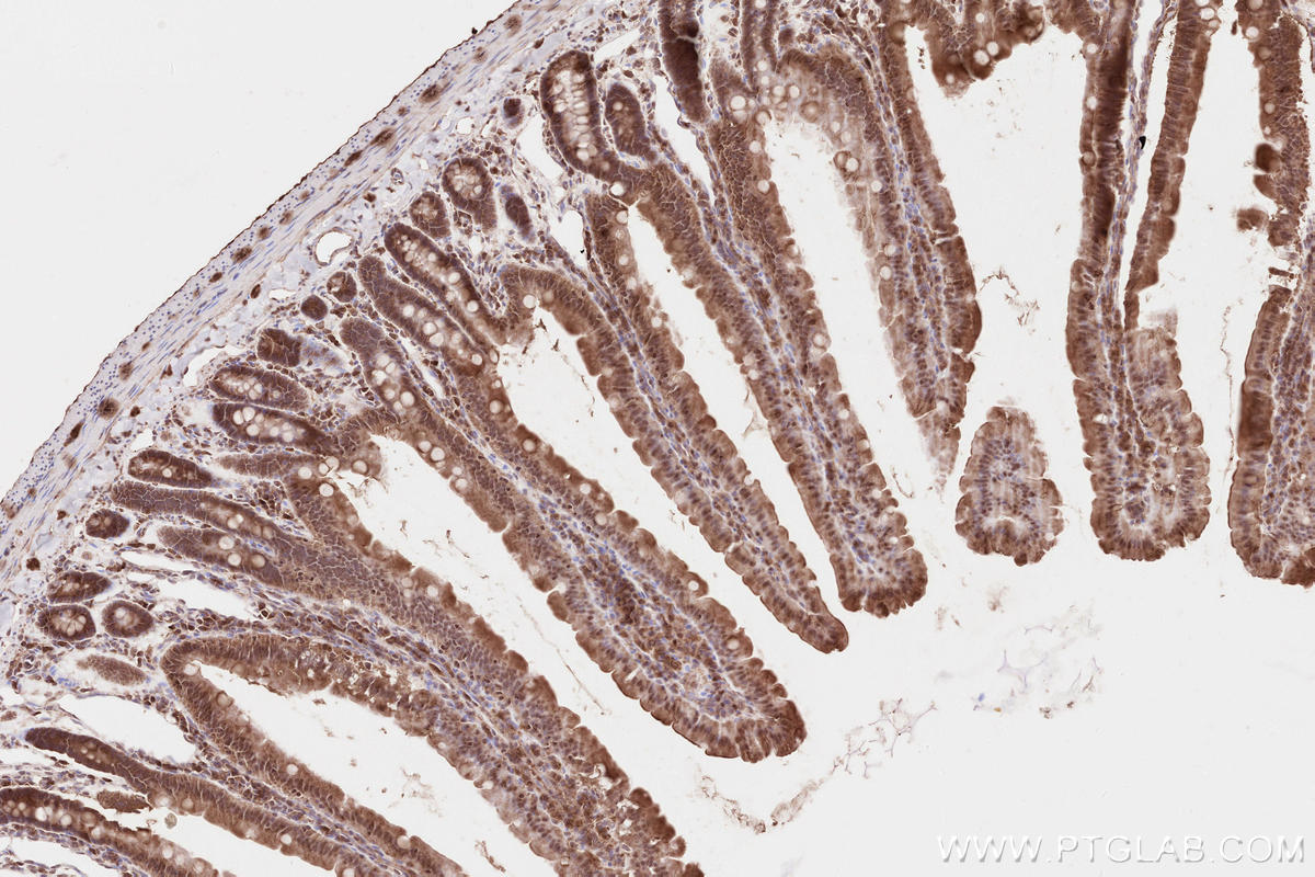 Immunohistochemistry (IHC) staining of rat small intestine tissue using IQGAP3 Polyclonal antibody (25930-1-AP)