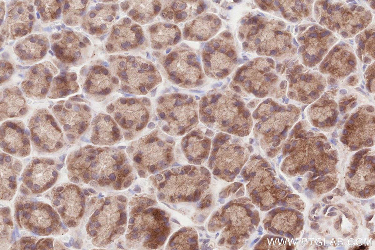 Immunohistochemistry (IHC) staining of rat stomach tissue using IQGAP3 Polyclonal antibody (25930-1-AP)