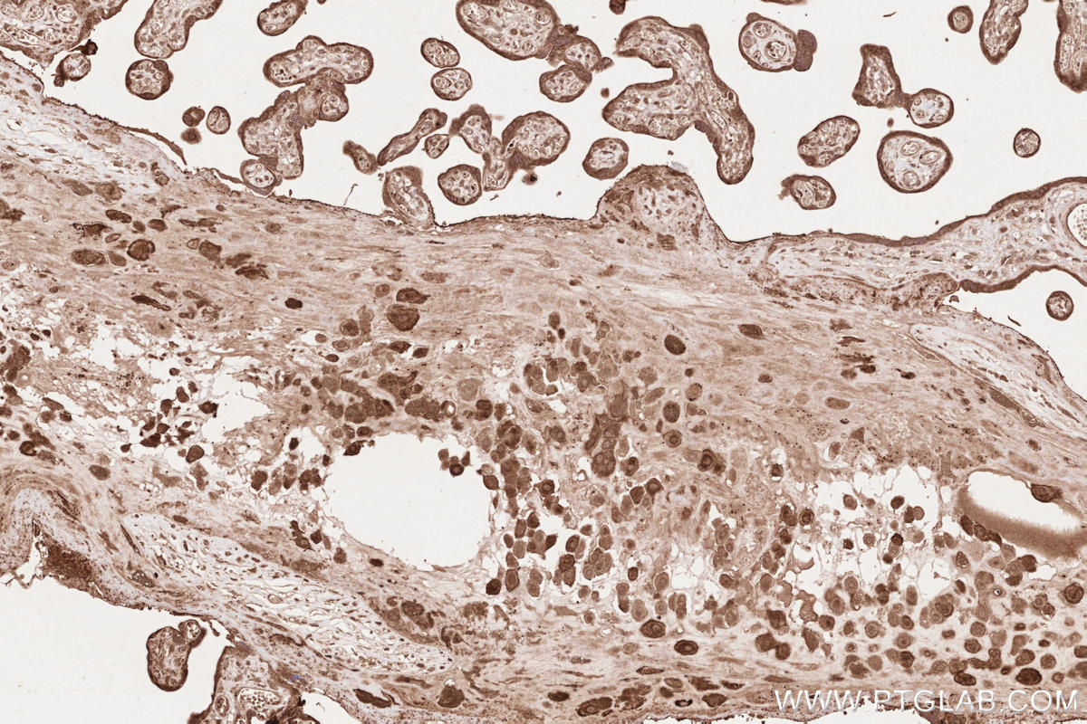 Immunohistochemistry (IHC) staining of human placenta tissue using IQGAP3 Polyclonal antibody (25930-1-AP)