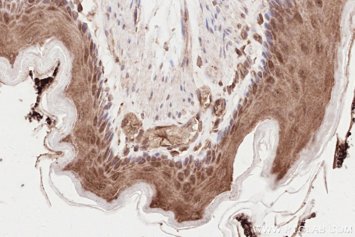 Immunohistochemistry (IHC) staining of rat stomach tissue using IQGAP3 Polyclonal antibody (25930-1-AP)