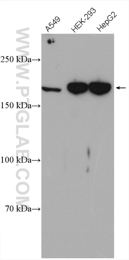Western Blot (WB) analysis of various lysates using IQGAP3 Polyclonal antibody (25930-1-AP)