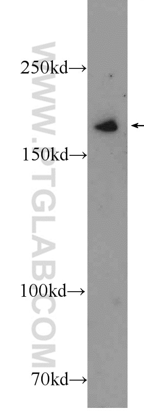 WB analysis of A431 using 25930-1-AP