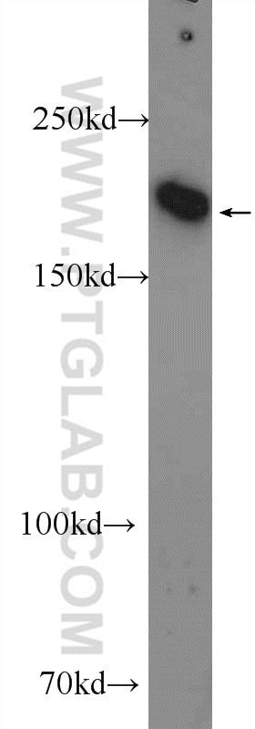 Western Blot (WB) analysis of MCF-7 cells using IQGAP3 Polyclonal antibody (25930-1-AP)