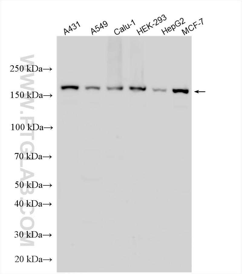 WB analysis using 25930-1-AP Western Blot (WB) analysis of various lysates using IQGAP3 Polyclonal antibody (25930-1-AP)
