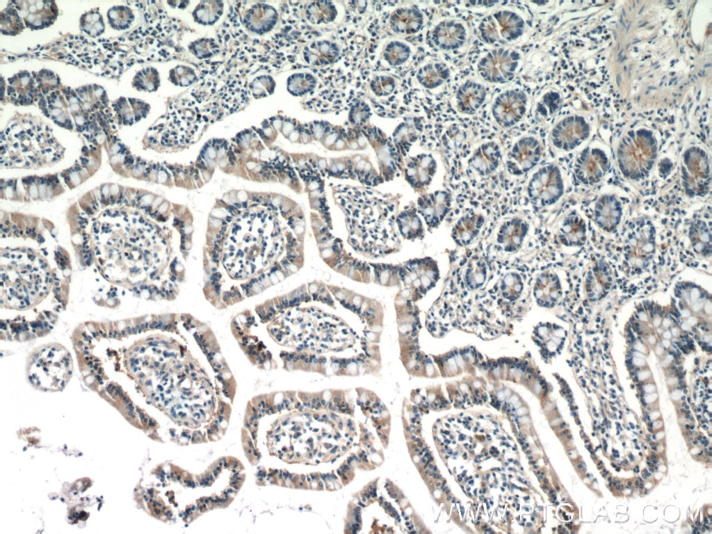 Immunohistochemistry (IHC) staining of human small intestine tissue using IQSEC2 Polyclonal antibody (25321-1-AP)
