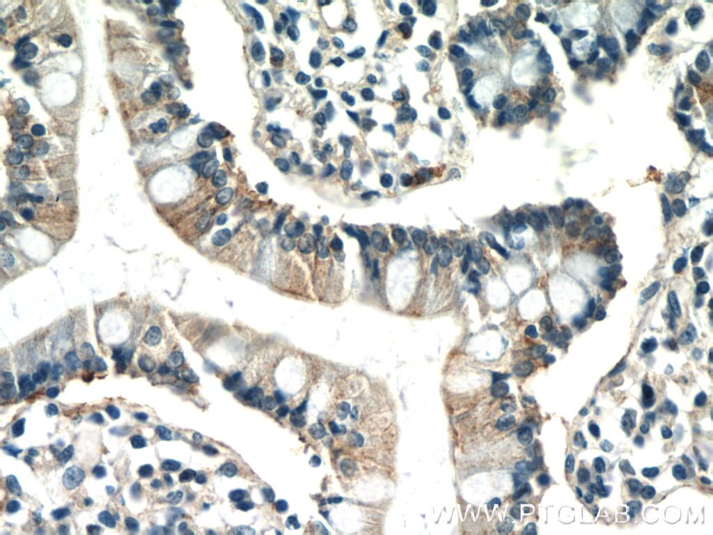 IHC staining of human small intestine using 25321-1-AP