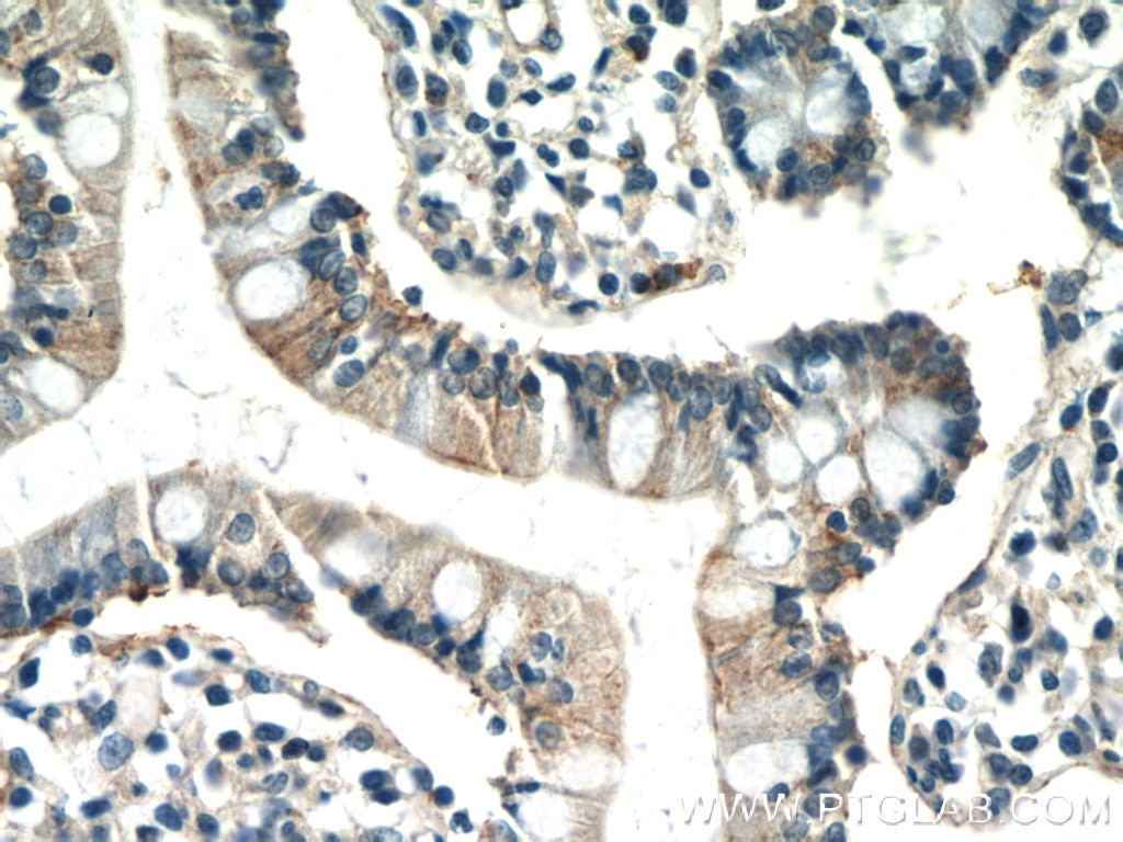 Immunohistochemistry (IHC) staining of human small intestine tissue using IQSEC2 Polyclonal antibody (25321-1-AP)