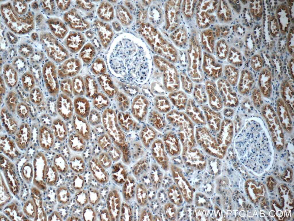 Immunohistochemistry (IHC) staining of human kidney tissue using IQSEC2 Polyclonal antibody (25321-1-AP)