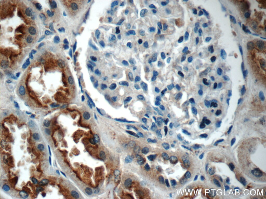 Immunohistochemistry (IHC) staining of human kidney tissue using IQSEC2 Polyclonal antibody (25321-1-AP)