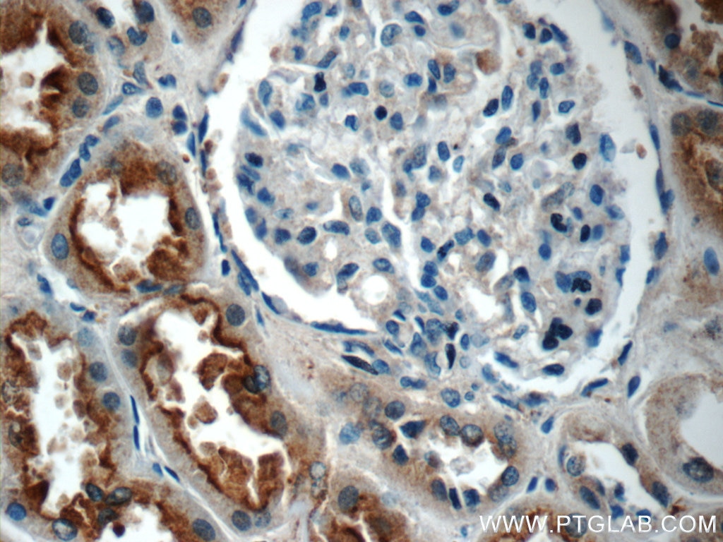 IHC staining of human kidney using 25321-1-AP