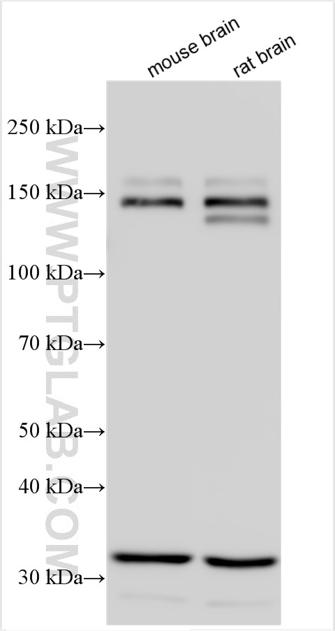 Western Blot (WB) analysis of various lysates using IQSEC3 Polyclonal antibody (22411-1-AP)