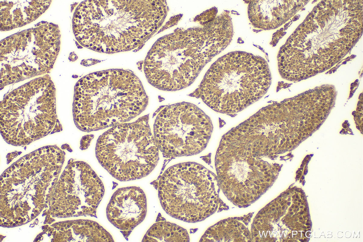 Immunohistochemistry (IHC) staining of mouse testis tissue using IQUB Polyclonal antibody (25605-1-AP)