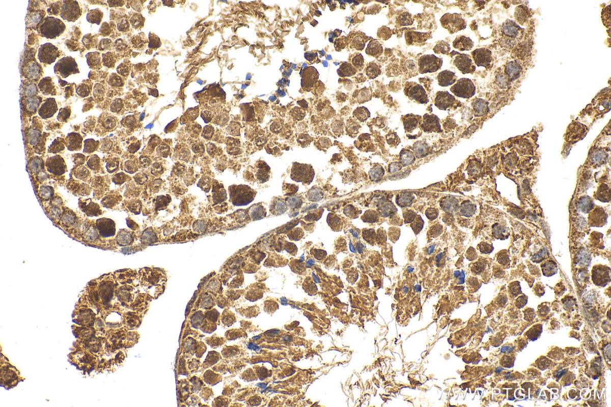 Immunohistochemistry (IHC) staining of mouse testis tissue using IQUB Polyclonal antibody (25605-1-AP)