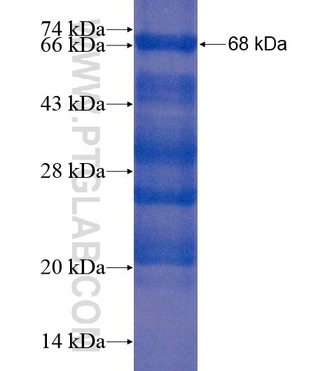 IQUB fusion protein Ag19507 SDS-PAGE