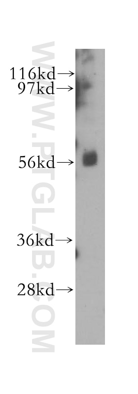 Western Blot (WB) analysis of HeLa cells using NRIP Polyclonal antibody (11632-1-AP)