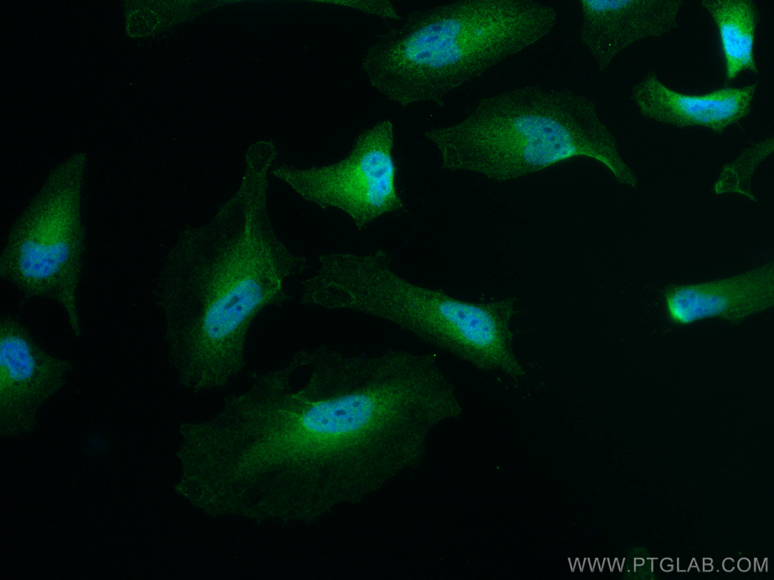 Immunofluorescence (IF) / fluorescent staining of HeLa cells using IRAK1 Polyclonal antibody (10478-2-AP)