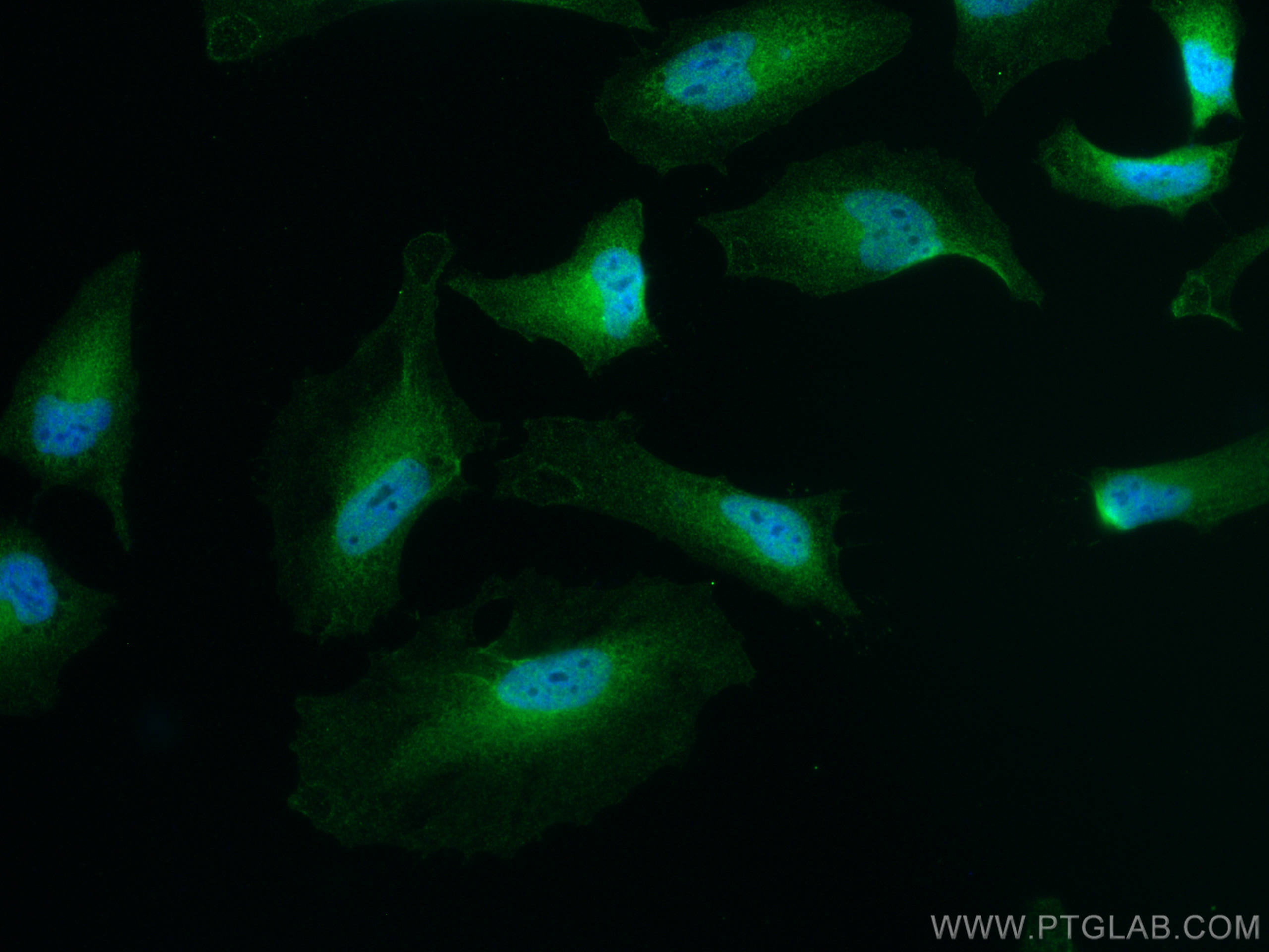 IF Staining of HeLa using 10478-2-AP