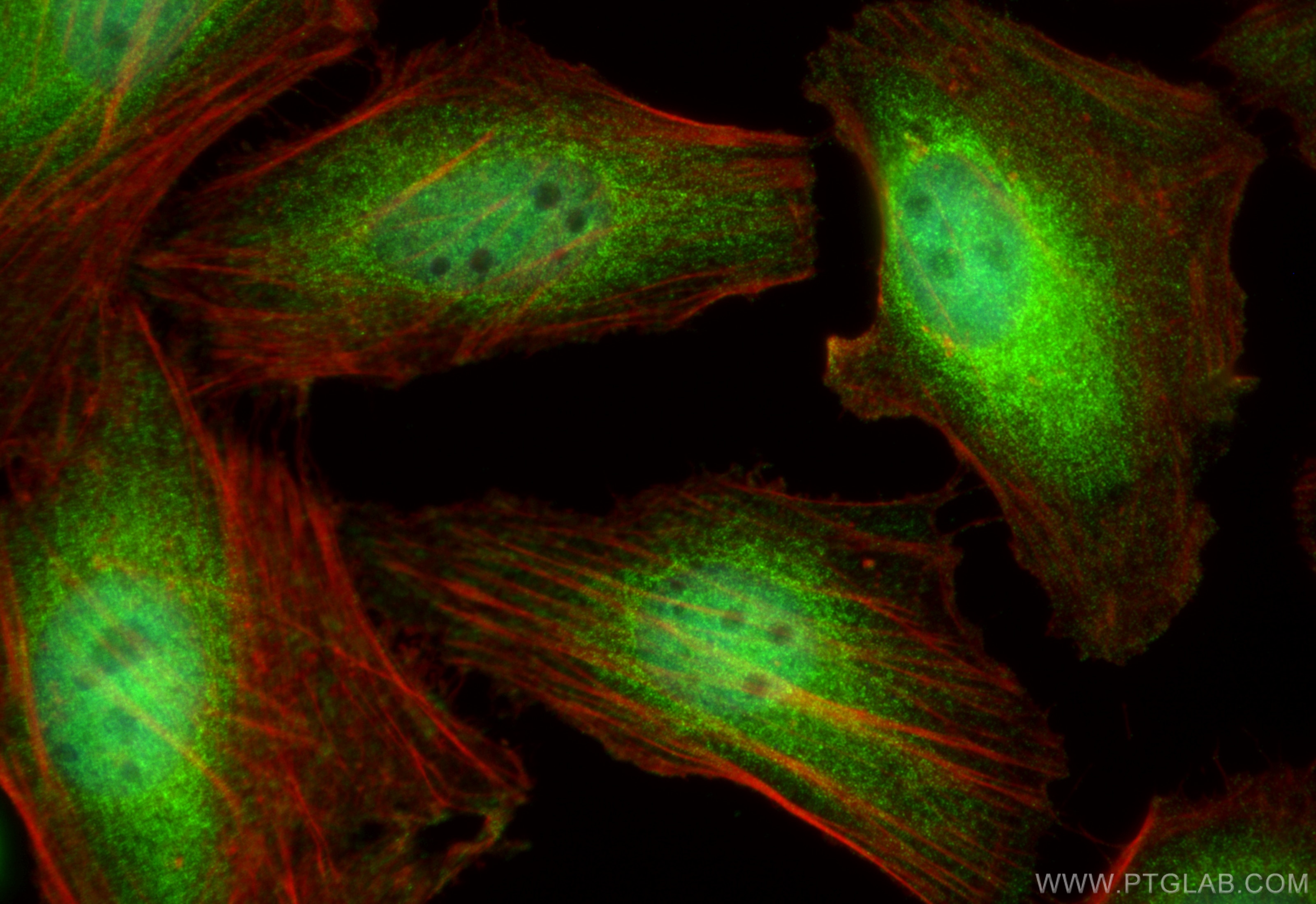 Immunofluorescence (IF) / fluorescent staining of HeLa cells using IRAK1 Polyclonal antibody (10478-2-AP)