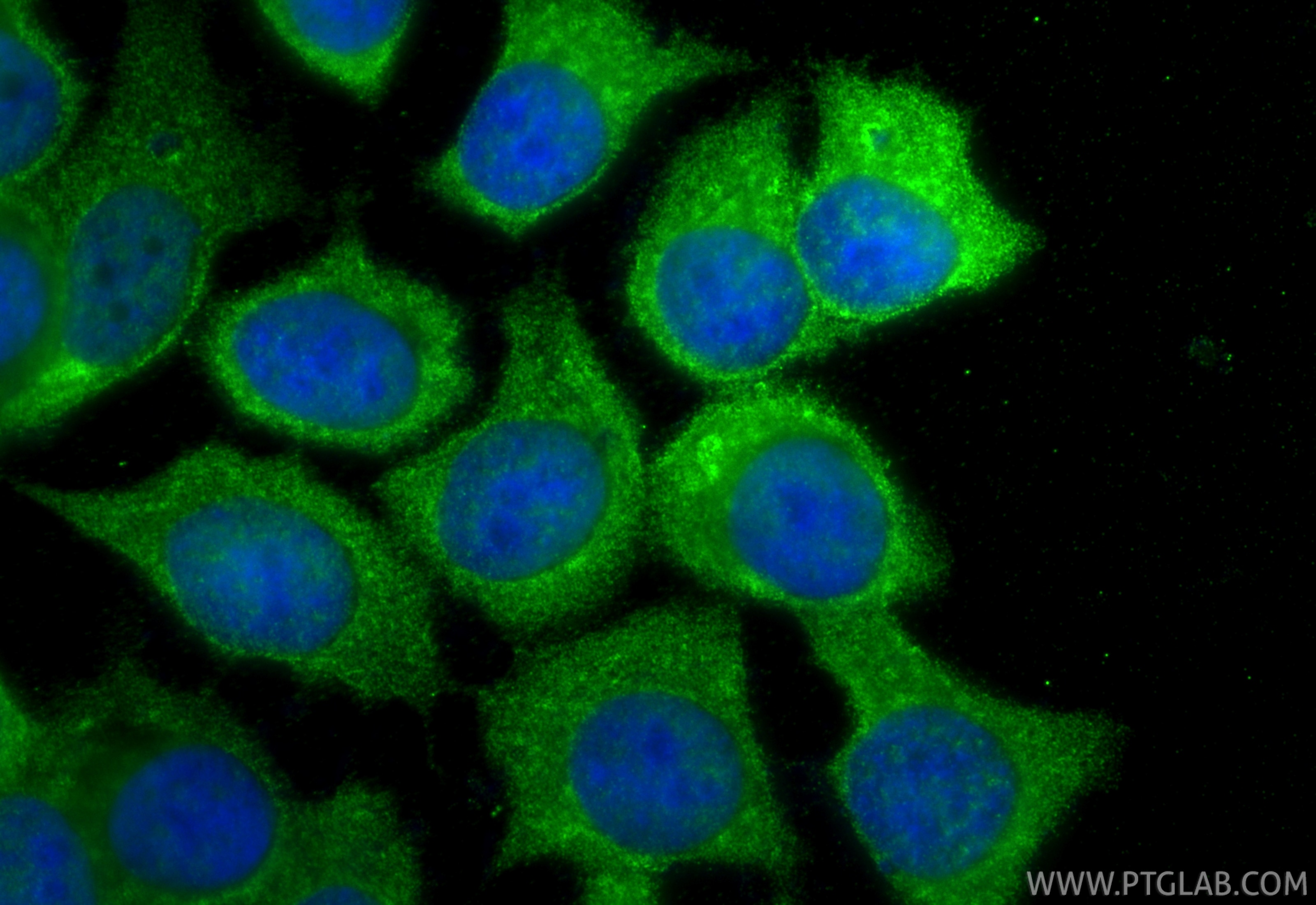 Immunofluorescence (IF) / fluorescent staining of MCF-7 cells using IRAK1 Polyclonal antibody (10478-2-AP)