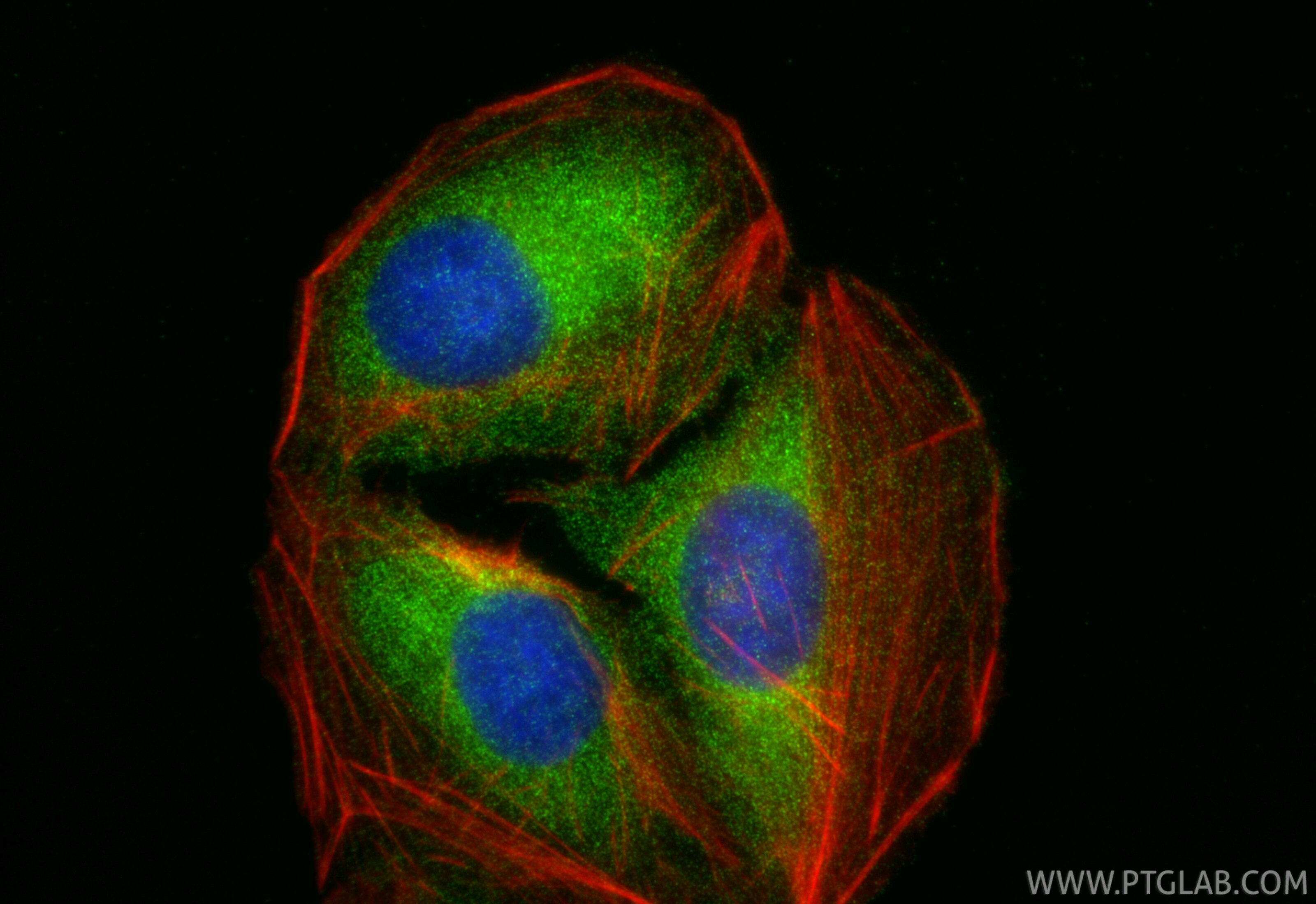 Immunofluorescence (IF) / fluorescent staining of U2OS cells using IRAK1 Polyclonal antibody (10478-2-AP)