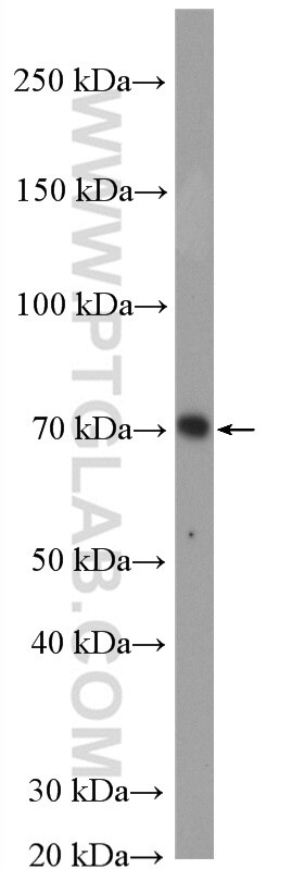 Western Blot (WB) analysis of RAW 264.7 cells using IRAK1 Polyclonal antibody (10478-2-AP)