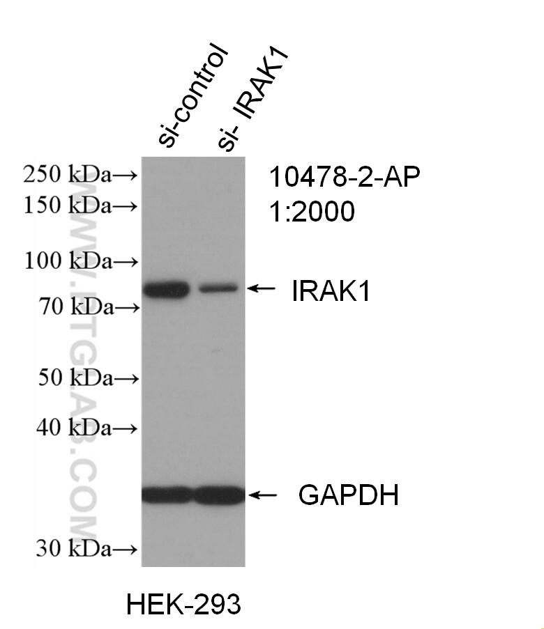 Western Blot (WB) analysis of HEK-293 cells using IRAK1 Polyclonal antibody (10478-2-AP)
