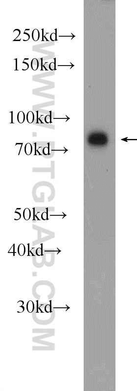 Western Blot (WB) analysis of PC-13 cells using IRAK1 Polyclonal antibody (10478-2-AP)