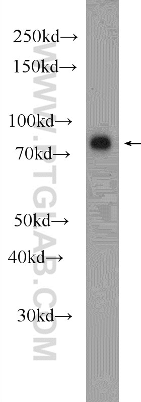 WB analysis of PC-13 using 10478-2-AP