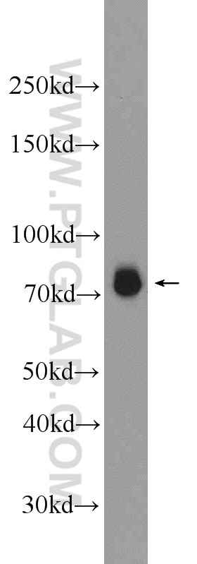 IRAK1 Polyclonal antibody
